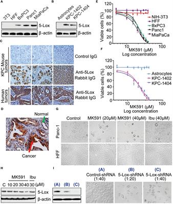 MK591 (Quiflapon), a 5-lipoxygenase inhibitor, kills pancreatic cancer cells via downregulation of protein kinase C-epsilon